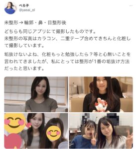 【画像】女さん「整形をバカにする陰へ」wwwwwwwwww