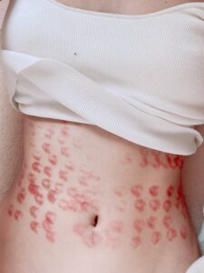 【悲報】AV女優さん、YouTuberが院長を務める美容クリニックで手術してヤバいことになってしまうwww