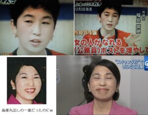 【美容整形】 韓国でのトレンドが変化、これからは〝復元〟の需要が高まる？　アジア人ならではの美しさ追及も[08/16]  [LingLing★]