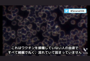 【ワクチン国内製造】モデルナ、日本にワクチン製造拠点の整備検討…BA・5対応は「11~12月に」
