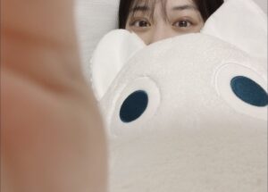 【証拠あり】山下美月さんがこの期に及んで二重まぶたの整形してて大ショック！！！！！！！