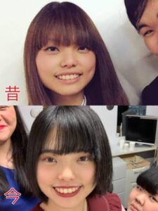 【画像】女芸人さん、整形していた「男は結局見た目で判断。昔からコンプレックスだった」
