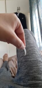 【画像】ポテチとか硬いもの食べたりアツアツの料理食べると口の中の粘膜が剥がれるんやがワイだけ?