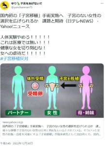 子宮のない女性に健康な女性の子宮を移植する「子宮移植」、始まる